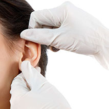 Отопластика хирургическая коррекция формы ушной раковины